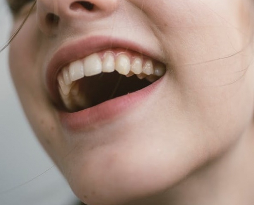Troubles psychosomatiques liés à la bouche et aux dents